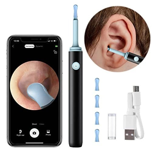 Evox™ - 2026 New Smart Earwax Cleaning Kit with Camera | 1080p HD Macro Camera Kit