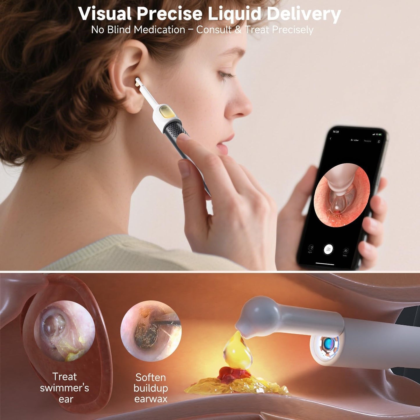 Evox™ - 2026 New Smart Earwax Cleaning Kit with Camera | 1080p HD Macro Camera Kit