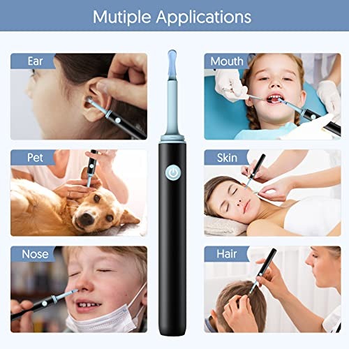 Evox™ - 2026 New Smart Earwax Cleaning Kit with Camera | 1080p HD Macro Camera Kit