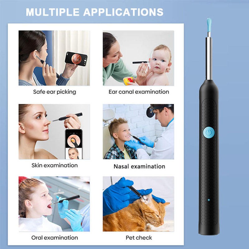 Evox™ - 2026 New Smart Earwax Cleaning Kit with Camera | 1080p HD Macro Camera Kit